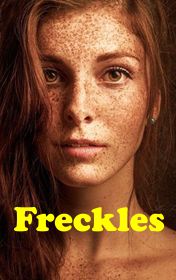 Andrew_Matthews-Freckles